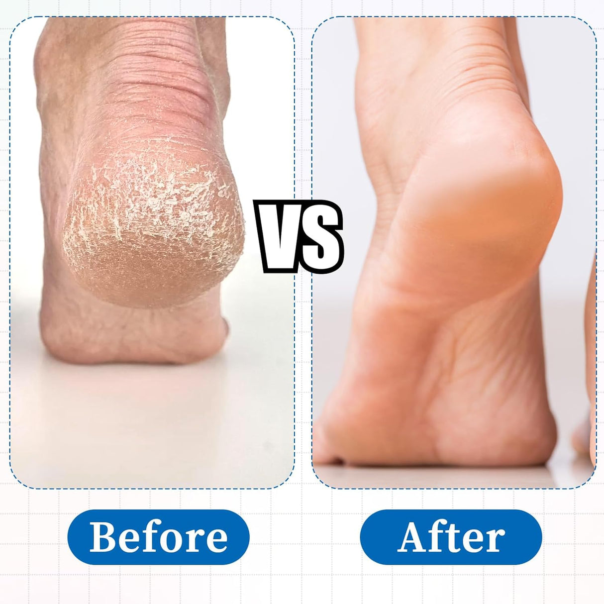 DISC NAIL DRILL BIT (WITH HOLDER)